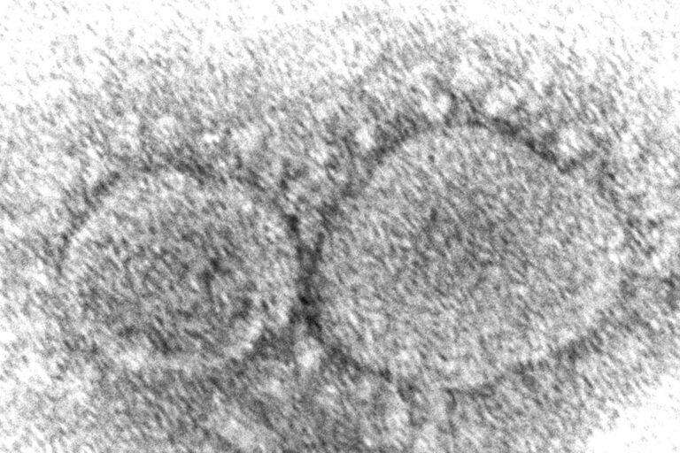 Coronavirus Origins Still a Mystery 3 Years into Pandemic